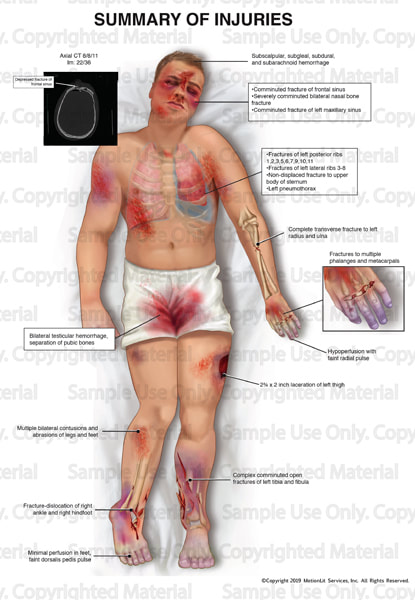 illustration-samples-summary-of-injuries-003_1