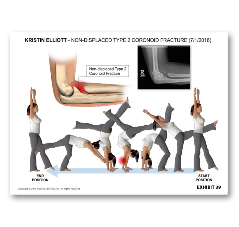 motionlit-exhibit-graphics-015-illustrations-orig_orig
